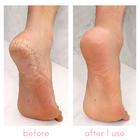 Kiara Sky -  Heel-ing Callus Remover Kit