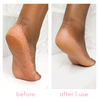 Kiara Sky -  Heel-ing Callus Remover Kit